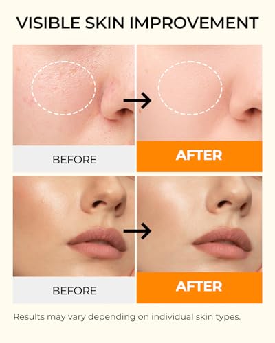 6 Sheet Masks Kojic Acid Turmeric Face Mask Even-Looking Skin Tone, Elasticity, Radiant, Hydrating Face Masks for Dull Skin Facial Mask Controlling Oil and Refining Pores Facemask Skincare - Image 4